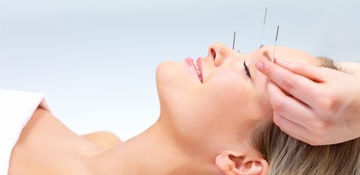acupuncture at the spa